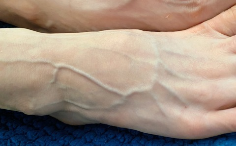 VeinyLittleFeet @veinylittlefeet cover picture